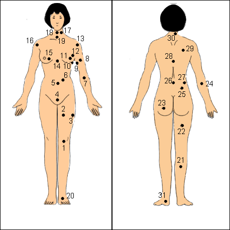 Vị trí nốt ruồi trên cơ thể phụ nữ