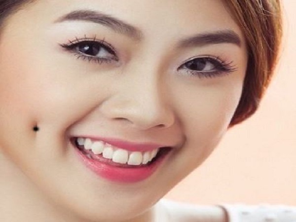Một số vị trí đặc biệt của nốt ruồi trên má và ý nghĩa liên quan đến vận mệnh