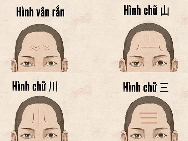 Các loại nếp nhăn trên trán phổ biến và vận mệnh liên quan