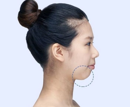 Dự đoán vận mệnh tương lai qua các tướng cằm đặc biệt