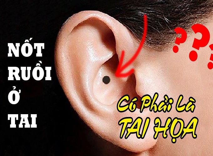 Xem bói nốt ruồi ở tai - vị trí vành tai
