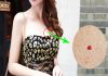 Luận nốt ruồi son mang lại may mắn ở vị trí nào quý nhất?