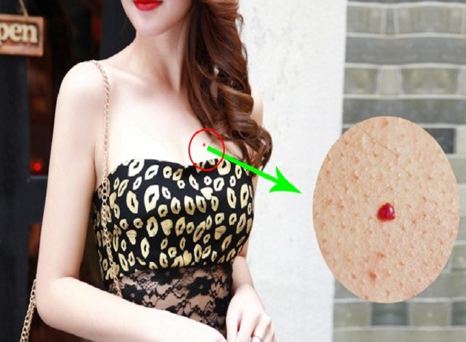 Nốt ruồi son trên tay mang may mắn về tài lộc và sự nghiệp
