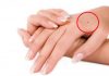 Nốt ruồi trên mu bàn tay có ý nghĩa gì nổi bật