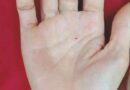 Xem bói nốt ruồi son trong lòng bàn tay chính xác nhất