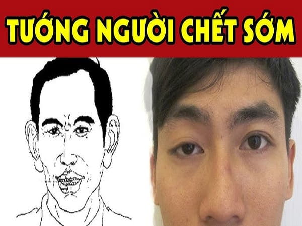 Tướng người chết sớm sẽ có huyệt thái đường nhạt nhòa