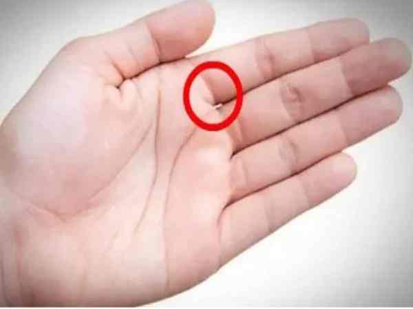 Nốt ruồi ở kẽ ngón tay có ý nghĩa gì?